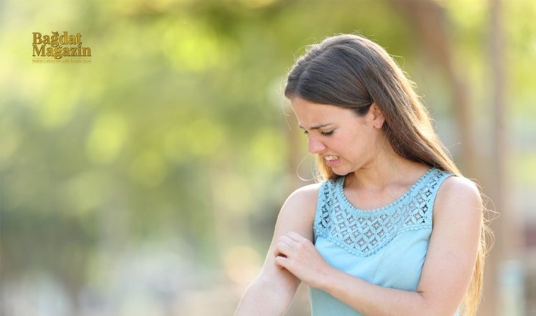 Böcek, sinek ve arı sokmasına dikkat!